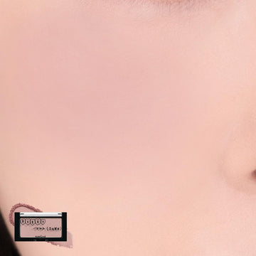 Normal Skin